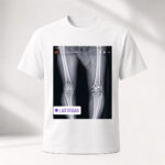 Unisex Funny Conor McGregor X Ray Broken Knee Graphic Shirt for MMA Fans