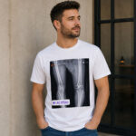 Unisex Funny Conor McGregor X Ray Broken Knee Graphic Shirt for MMA Fans