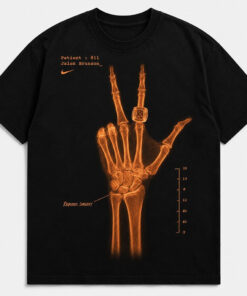 Unisex New York Knicks Jalen Brunson Wrist Surgery X-Ray Graphic Shirt for Basketball Fans
